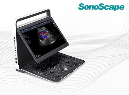SonoScape E2 HD