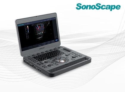 SonoScape X3