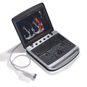 Chison Sonobook 7 bei Sonowied