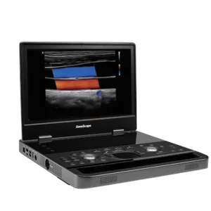 SonoScape E10