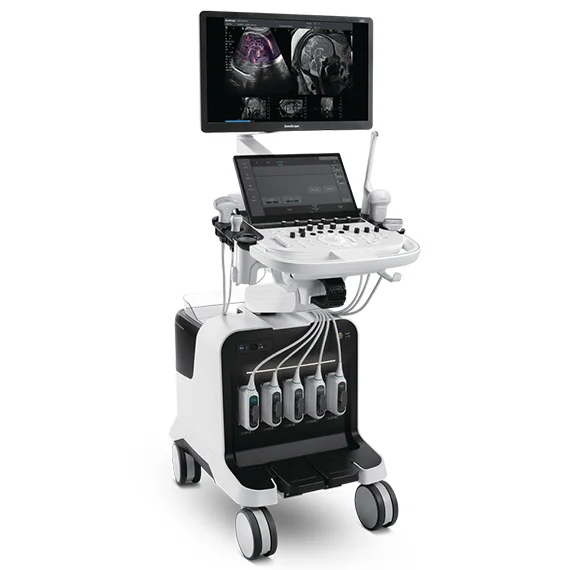 Sonoscape S80