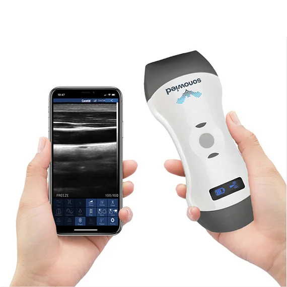Sonowied 3 in 1 Handheld Ultraschallgerät – Bild 3