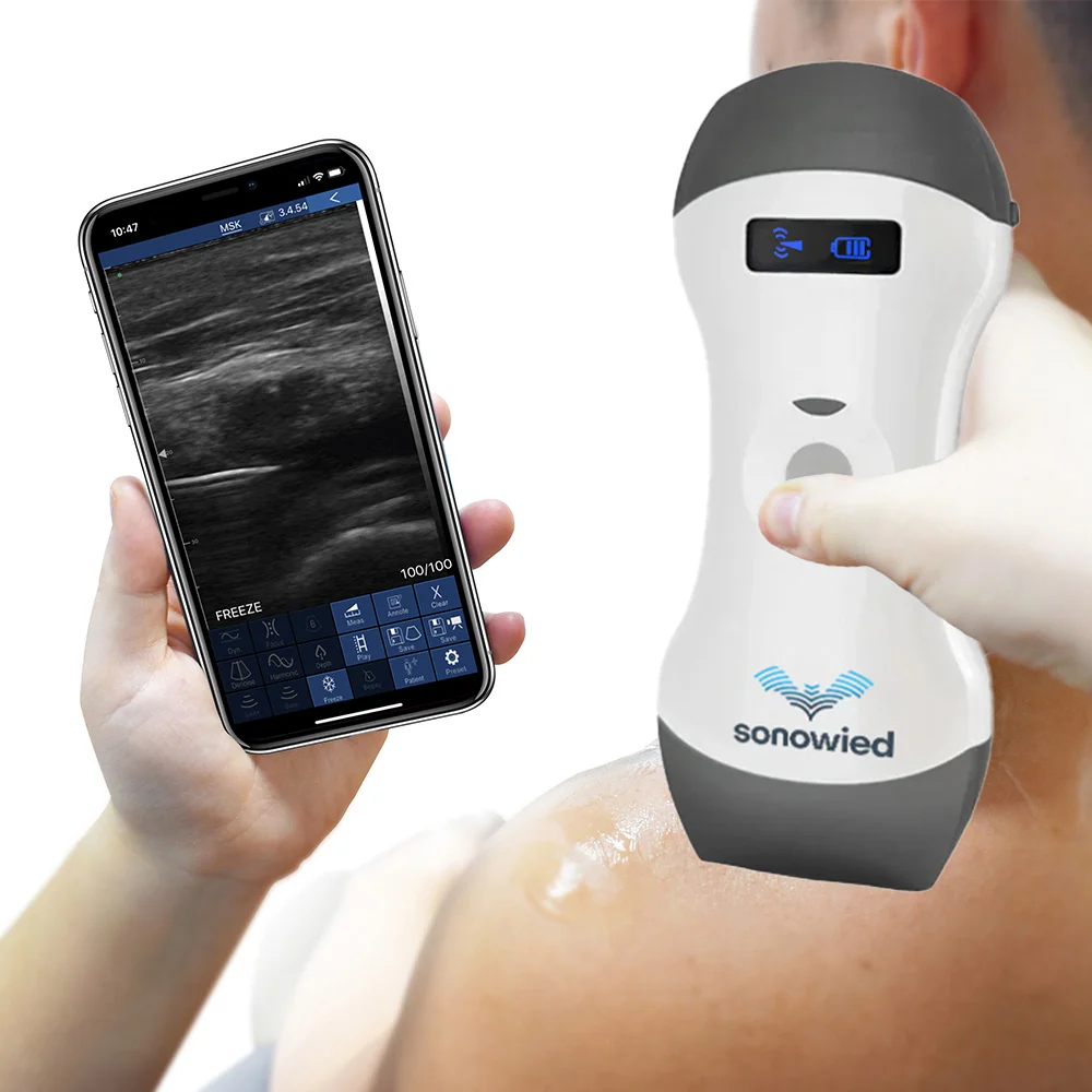 Sonowied 3 in 1 Handheld Ultraschallgerät – Bild 2